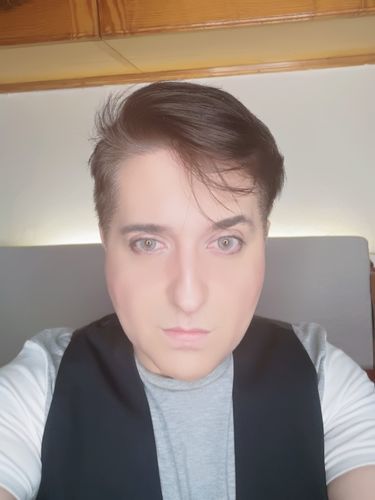 Customer photo review of MOJOSEE Glass Ball Grey Colored Contact Lenses