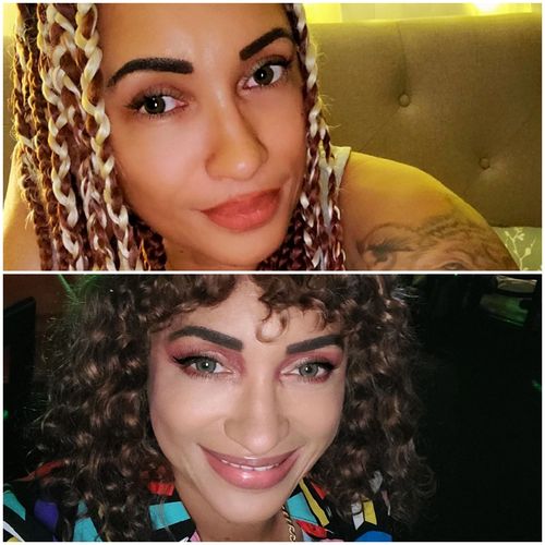 Customer photo review of Neala Green Contact Lenses(12 months wear)
