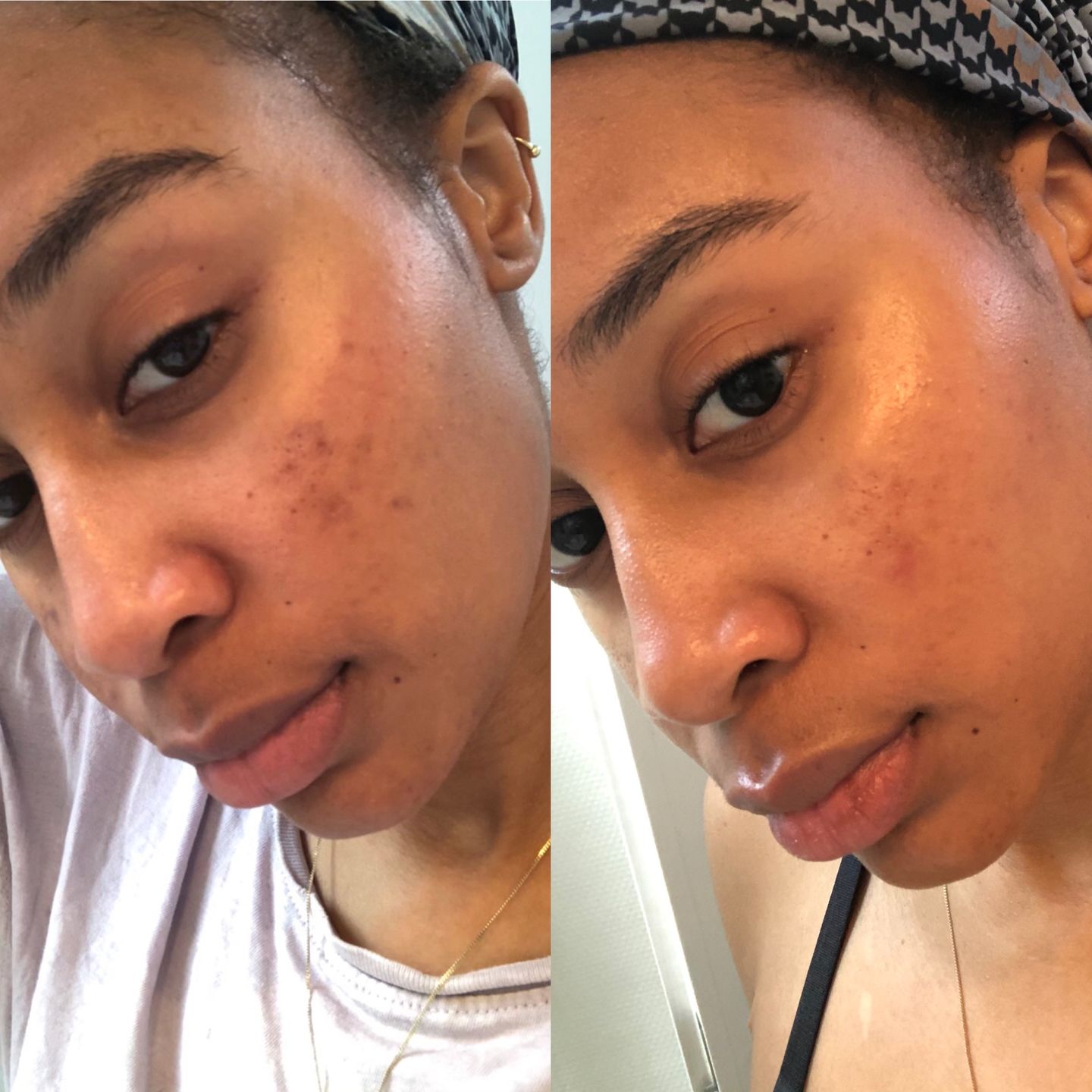 Customer photo review of [W]ASH AWAY - Purifying Gel Cleanser