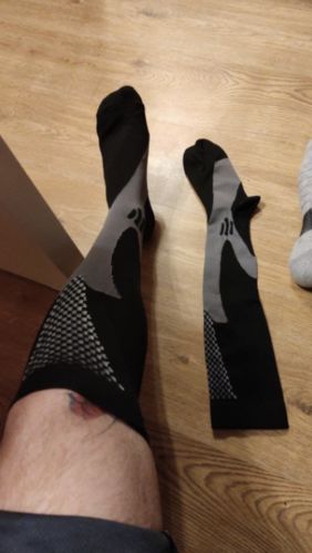 Customer photo review of MinasaMed Kompressionssocken für schmerzfreie Beine & Füße