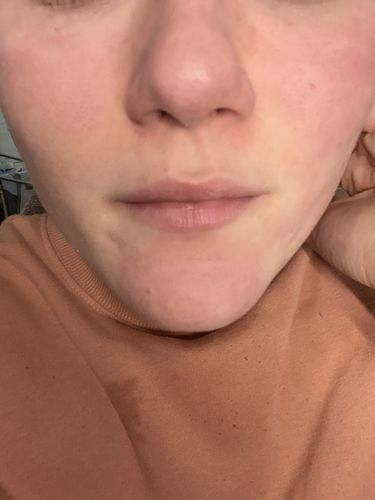 Customer photo review of HAUTREINIGER MaggyBeauty®