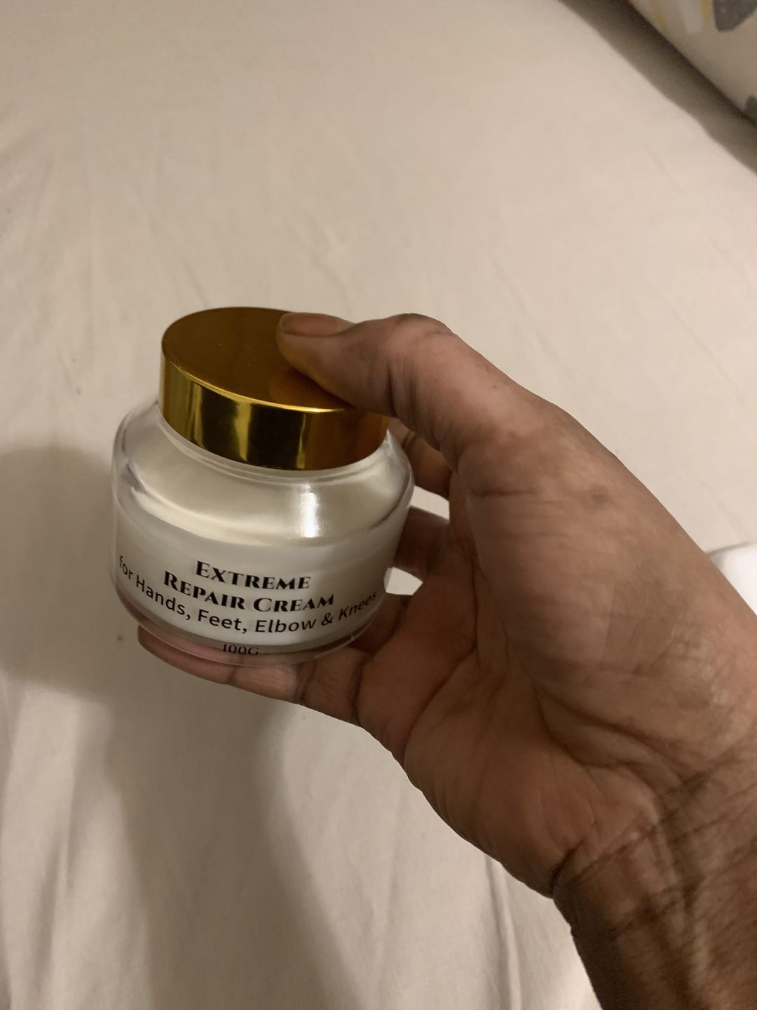 Customer photo review of Extreme Dark Hands Feet Knees And Elbows Repair Cream