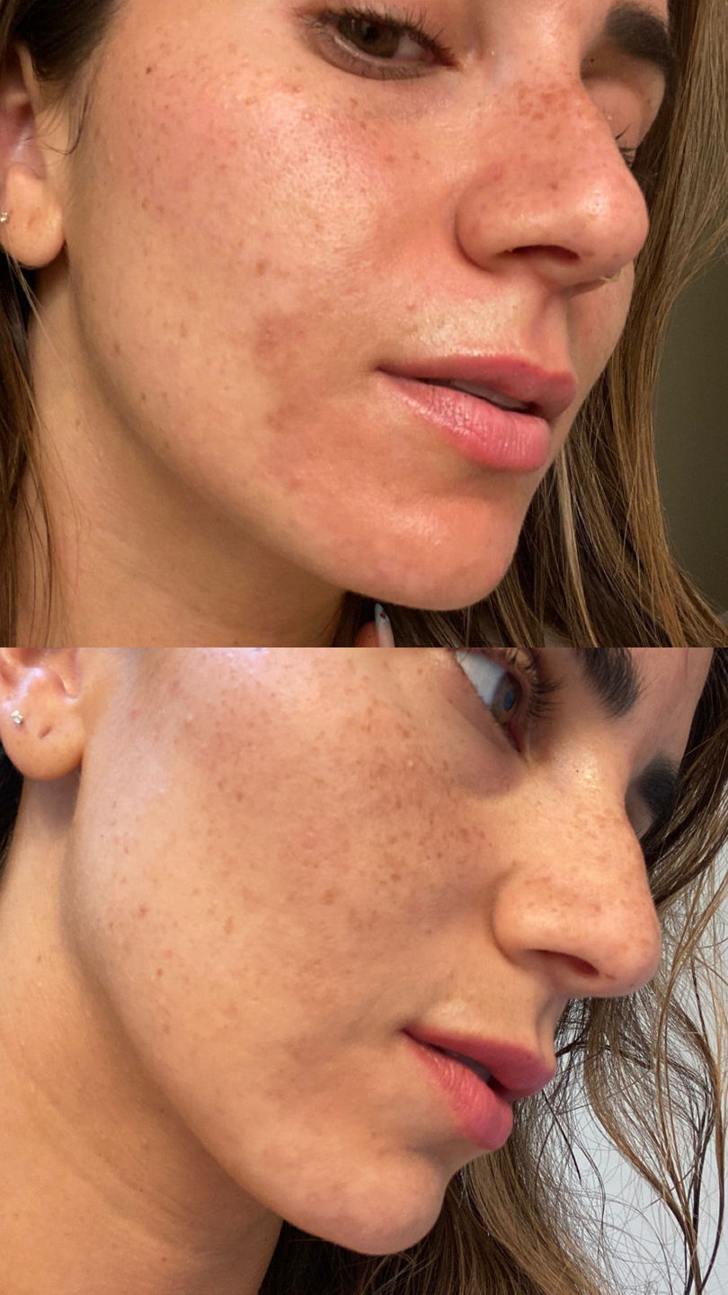 Customer photo review of Magix Cream