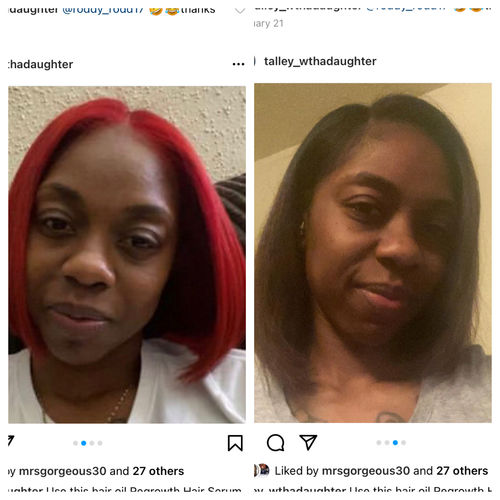 Customer photo review of Hair Regrowth Serum
