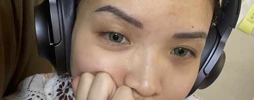 Customer photo review of Eyra Green Contact Lenses(12 months wear)