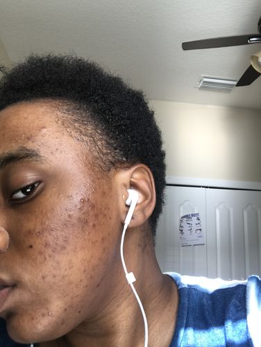 Customer photo review of Qasil Powder for Hair and Skin, Organic Qasil Powder, Qasil Powder for Face, Pack of 1, 150gm