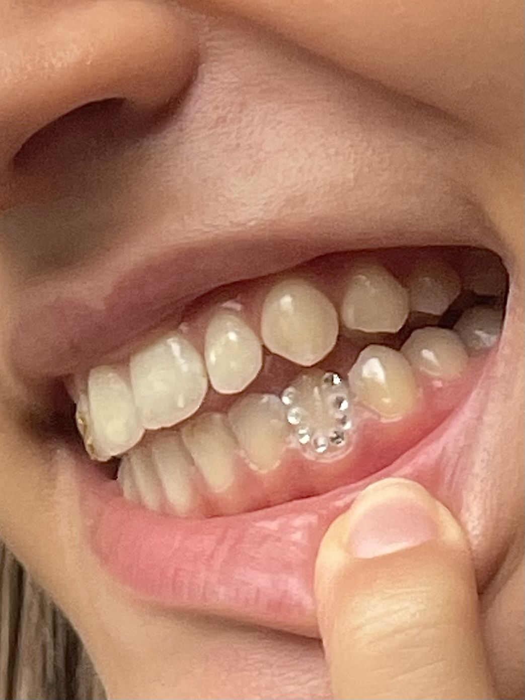 Customer photo review of Crystal Clear 1.8mm - 6-pack
