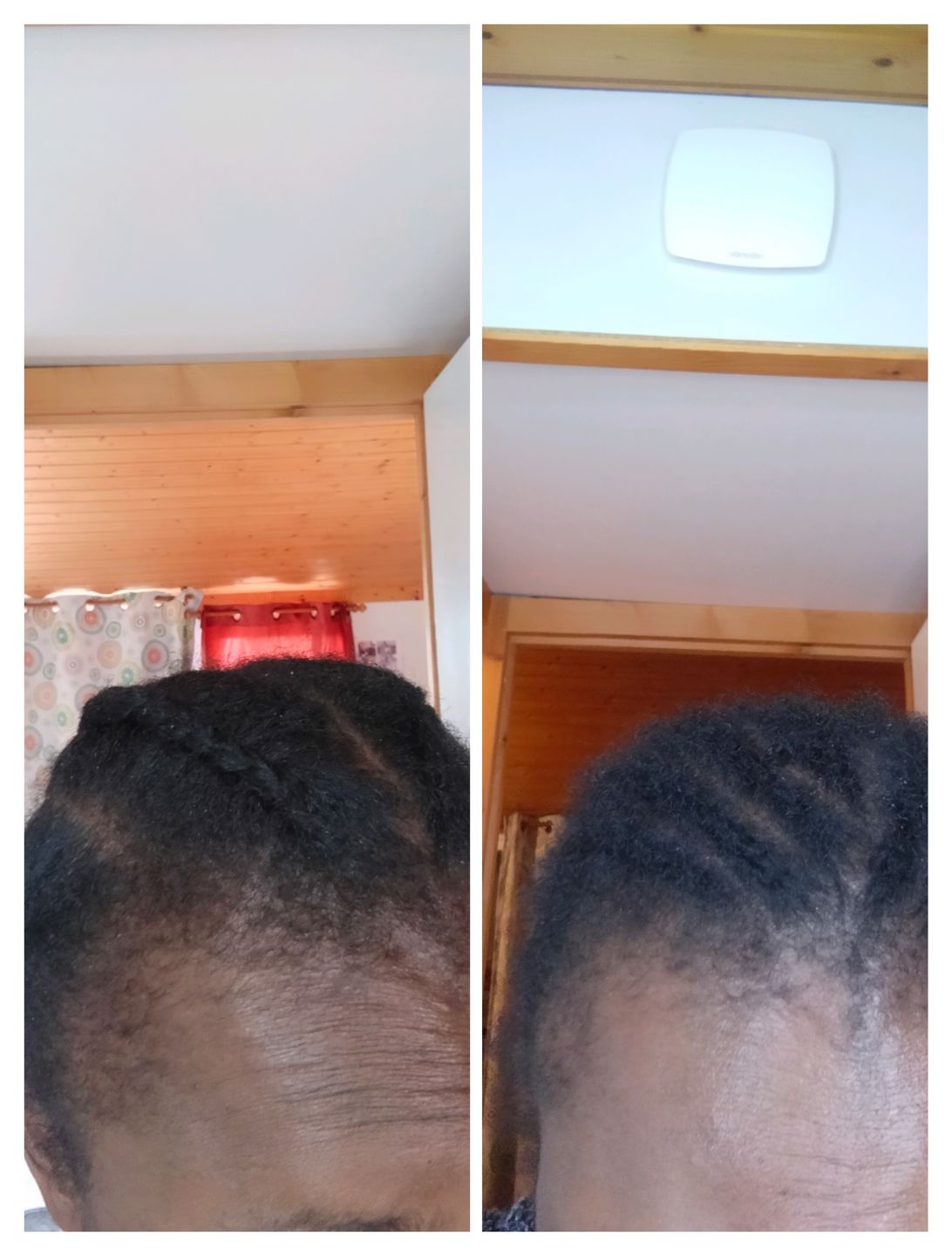 Customer photo review of INNER - VITAMINES POUR LES CHEVEUX - 1 MOIS