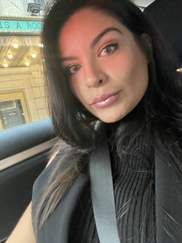 Customer photo review of [US Warehouse] Mel Prescription Contact Lenses