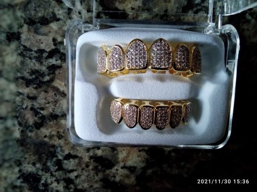 Customer photo review of Two-Tone Iced Grillz