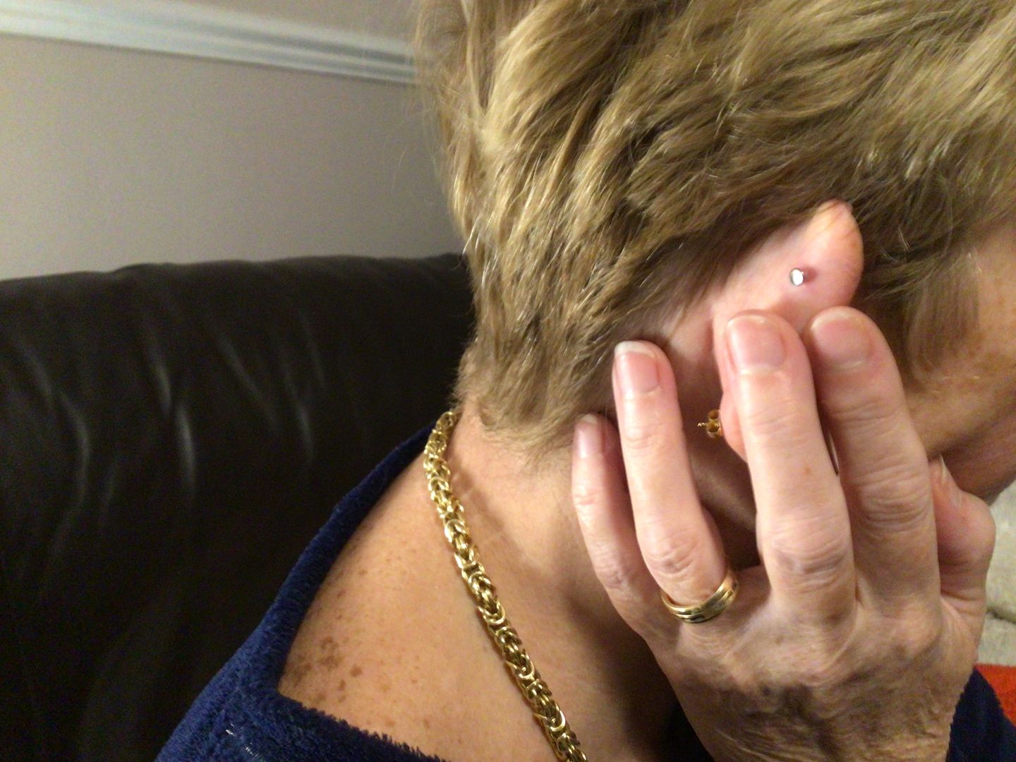 Customer photo review of Junipurr Titanium Flatback Labret Threadless