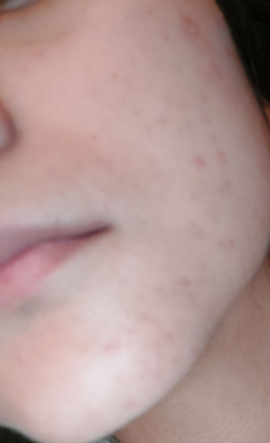 Customer photo review of Sleek Skin Serum 30ml