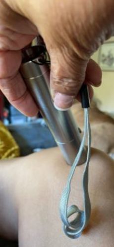 Customer photo review of QI LITE Mini Fast Joint Pain Relief for Neck, Knee, Muscle Red Light Therapy