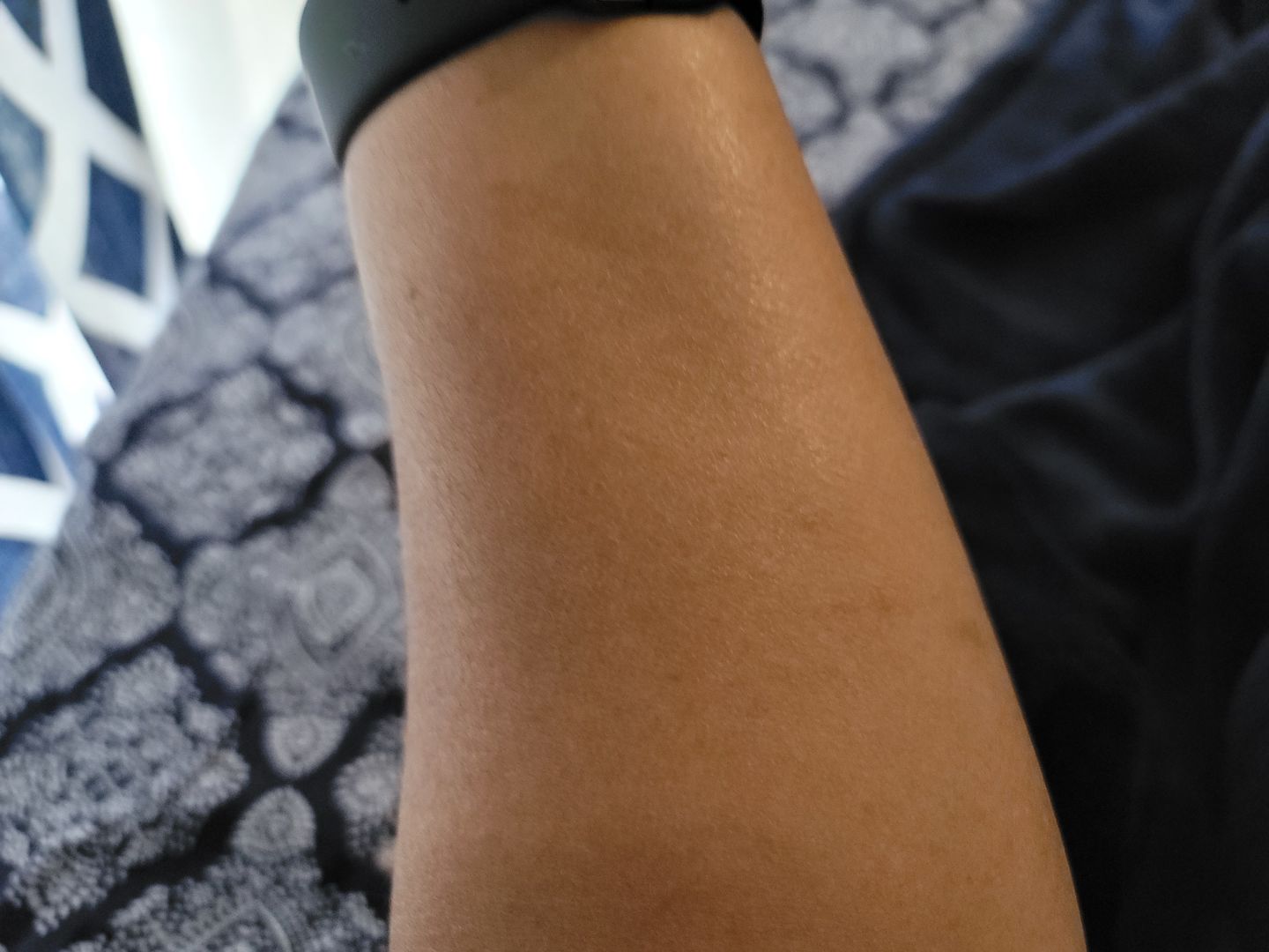 Customer photo review of Carotis 7 Day Lightening Cream with Vitamin A (Jar) - 300ml / 10.14 fl oz