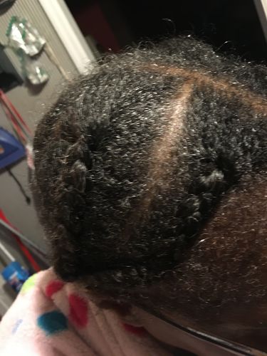 Customer photo review of [Step 6] HAIR BOOST: Nae Nae's Flagship Product