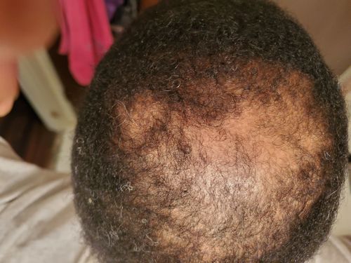 Customer photo review of Holistic Scalp Cream