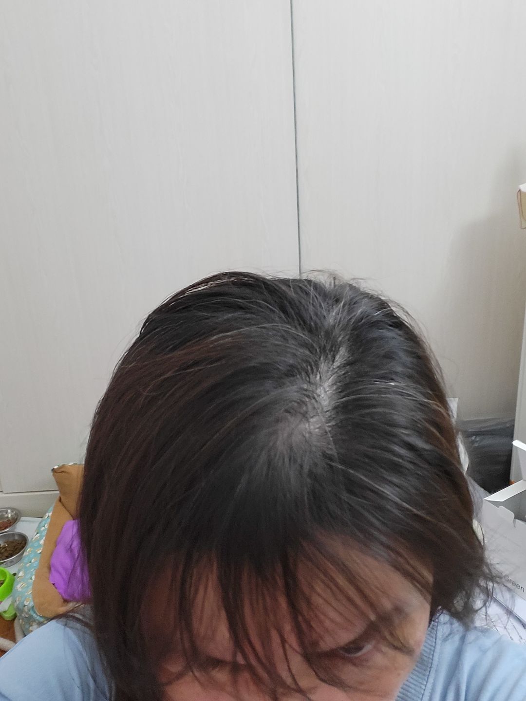 Customer photo review of [ SMIB ] - 500ML Coral Calcium Treatment