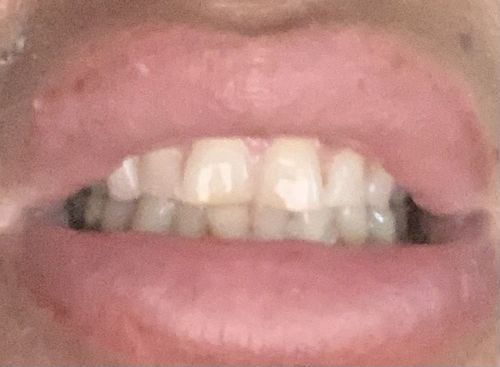 Customer photo review of SmileSecret Toothpaste // 3 für 1