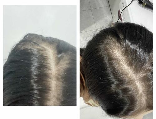 Customer photo review of Growth & Shine Hair Oil
