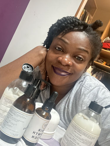 Customer photo review of Hair Recovery Bundle