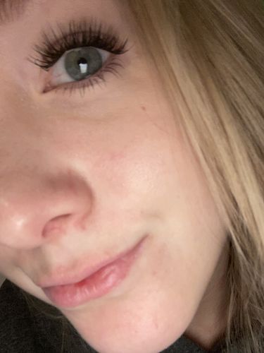Kundenbewertung mit Foto zu Flutter Fling