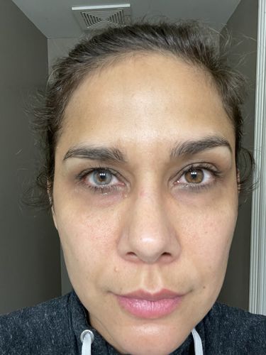 Customer photo review of [US Warehouse] Hidrocor Icy Grey Prescription Monthly Contact Lenses