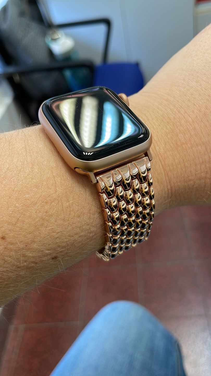 Customer photo review of Arya Stainless Strap (4 Colours)