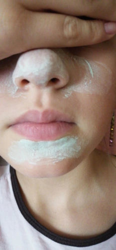 Customer photo review of Hot Sale - Deep Cleanse Natural Green Tea Face Mask