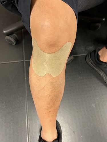Customer photo review of PATCH - Parche para Rodilla Natural