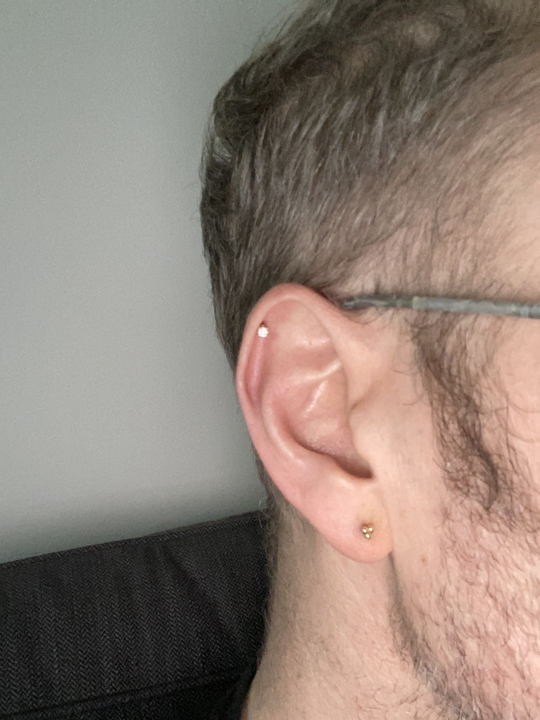 Customer photo review of NeilMed Sterile Saline Piercing Aftercare