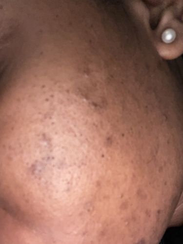 Marisa I. review of Qasil Powder for Hair and Skin, Organic Qasil Powder, Qasil Powder for Face, Pack of 1, 40gm image 1 out of 1