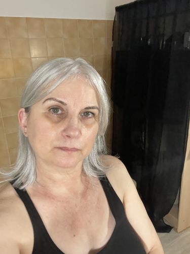 Customer photo review of Sarahbio - huile de pépins de figue de barbarie - 30 mL