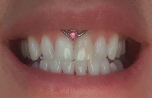 Customer photo review of GRATIS Pflegebundle