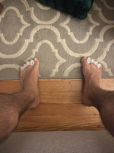 Customer photo review of Route Package Protection