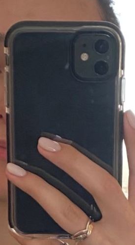 Customer photo review of Shockproof Transparent iPhone Case