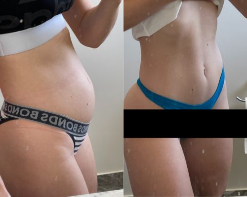 Customer photo review of 20-Day Inside & Out™ Gut Program
