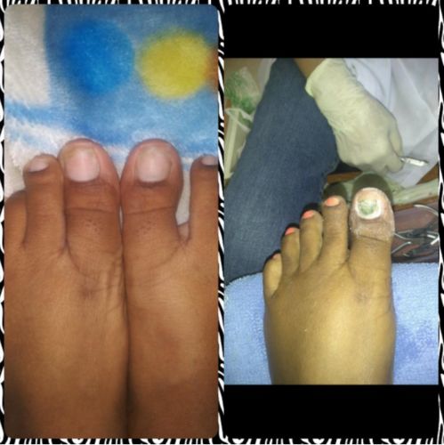 Customer photo review of Health Toe Instant Beauty Gel