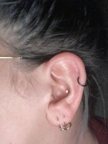 Customer photo review of Opal Prong Stone Titanium Internally Threaded Lip Ring