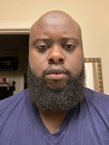 Customer photo review of Respected Roots Beard Hydration Kit