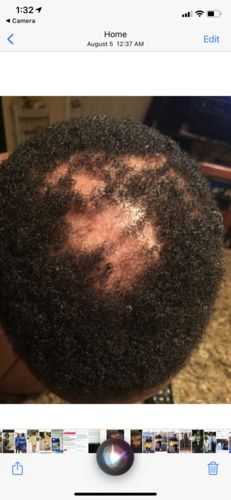 Customer photo review of PureFix Hair Elixir