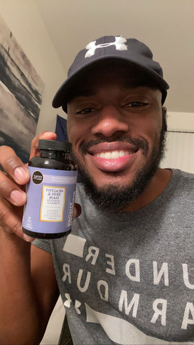 Customer photo review of HANDSOME BROTHA-Healthy Skin & Hair Advanced Formula Tablet (45 Day Supply/ .64 Cent A Day) CLICK HERE