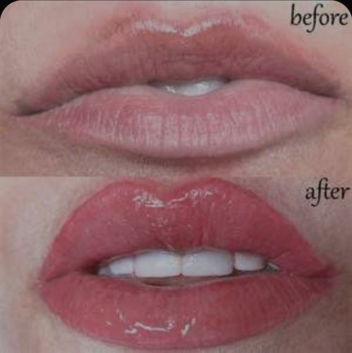 Customer photo review of LIP BOOSTING SYSTEM