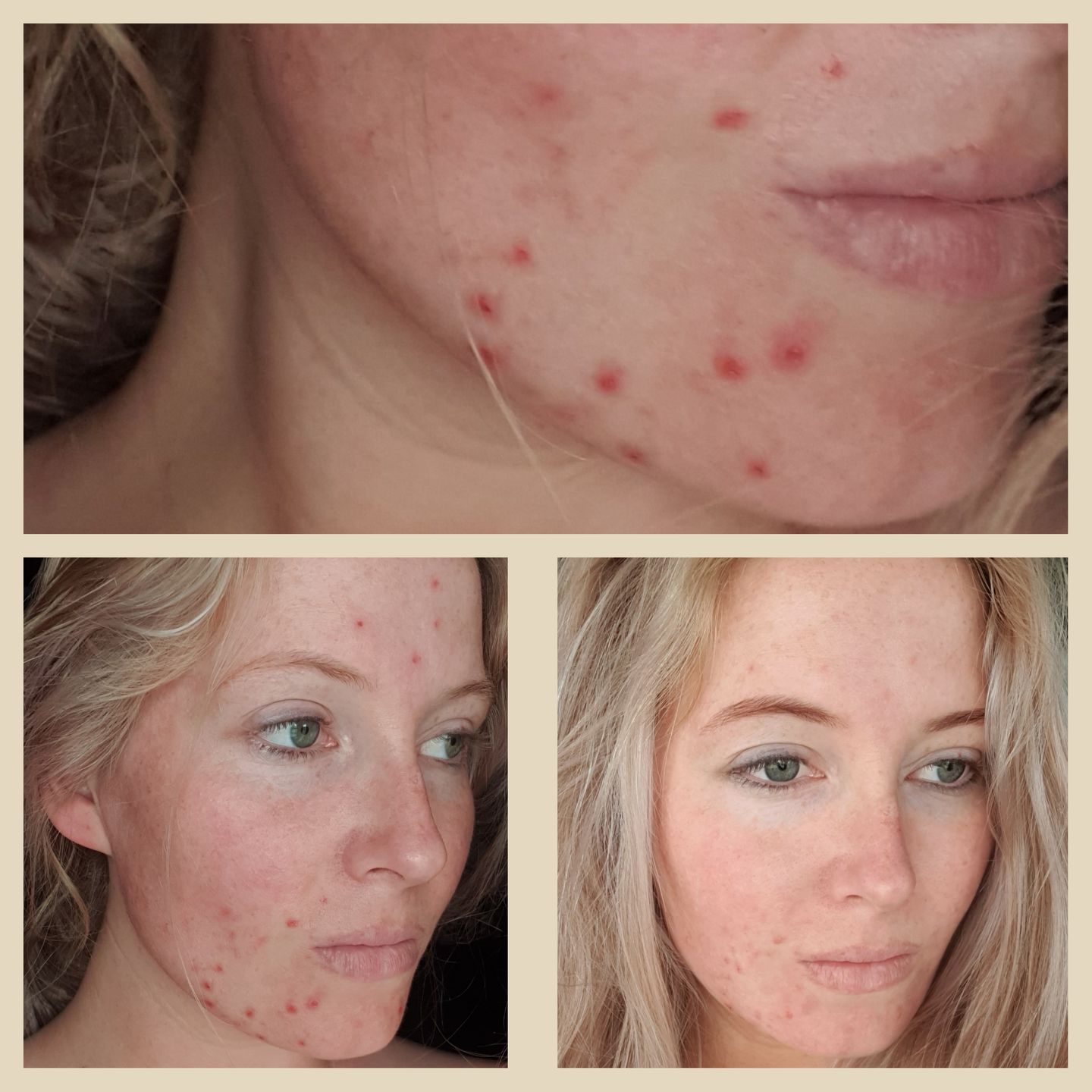 Customer photo review of Green Tea Cleanser