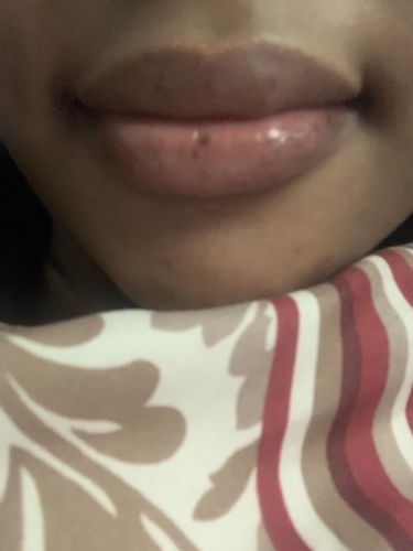 Customer photo review of LipFix: Lip Flip