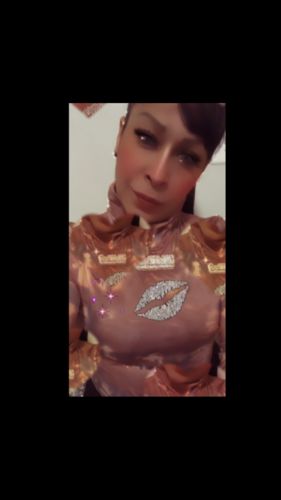 Customer photo review of Topaz Prescription Colored Contact Lenses