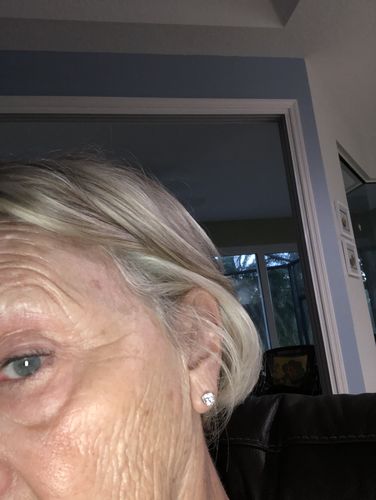 Customer photo review of Eye Lifting Serum