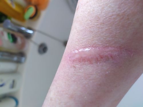Customer photo review of Skin Illustrator Love Shine 4oz
