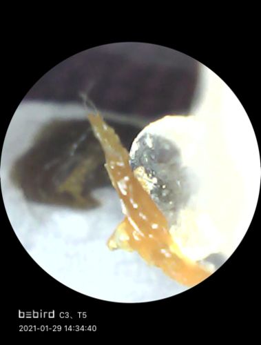 Customer photo review of Bee Gone Wax Ear Cleaner