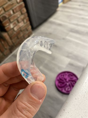 Customer photo review of 𝗔𝗣𝗘𝗫™