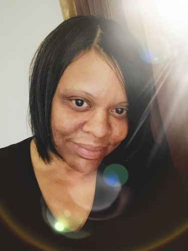 Customer photo review of (30%off)BEST SELLER (REGROWTH) Hair Serum Extra Strength